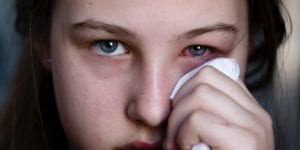 Conjuntivitis: vírica, bacteriana o alérgica