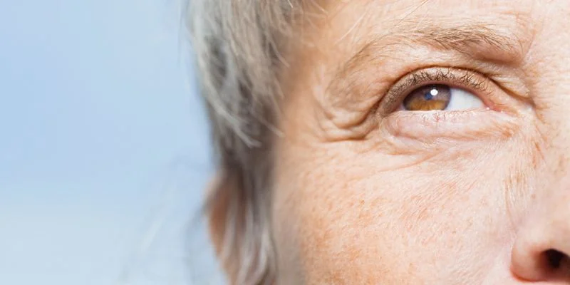 síndrome confusional agudo