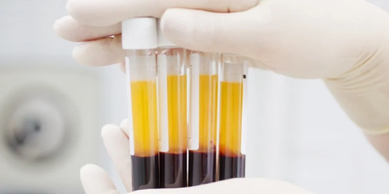 Plasma enriquecido