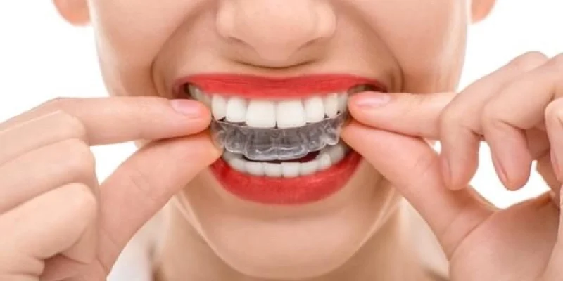 ortodoncia invisible