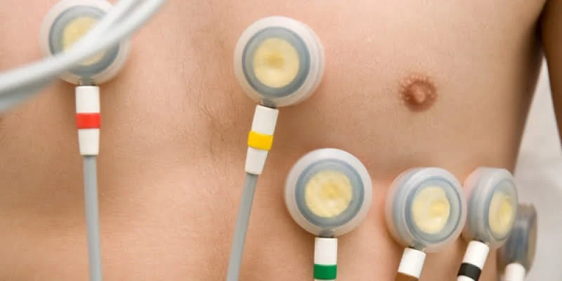 Holter de tensión