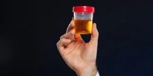 Qué es un urocultivo