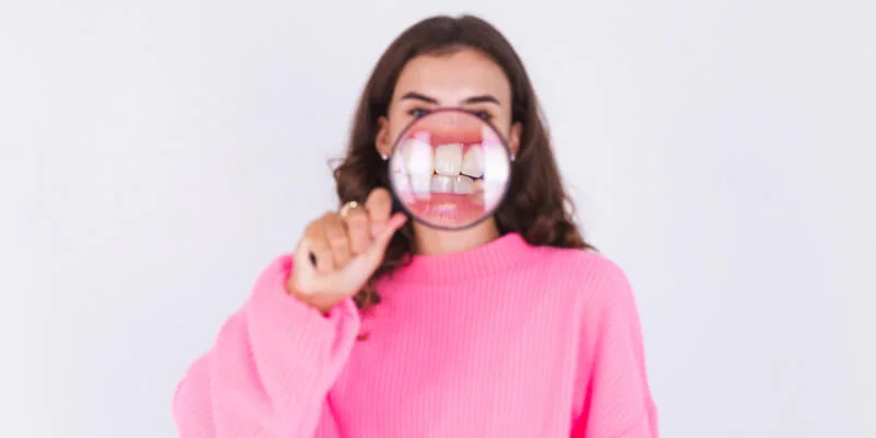 detalle de la dentadura donde puede haber manchas