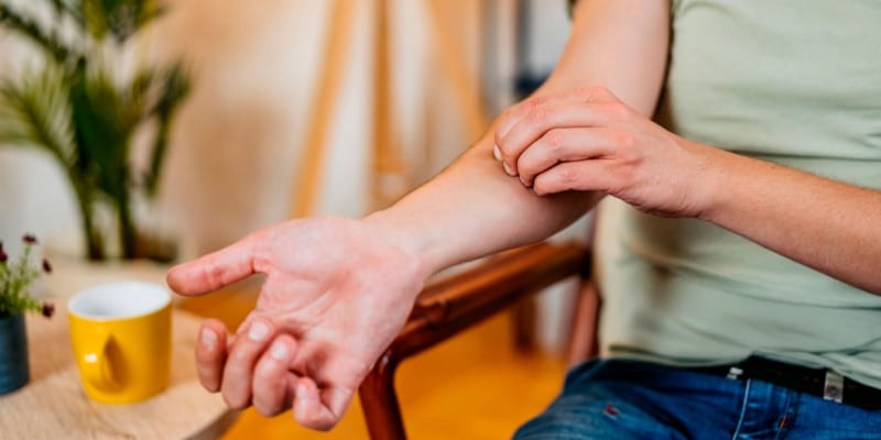dermatitis estrés picor