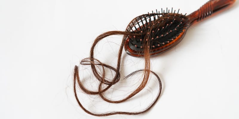 finasteride