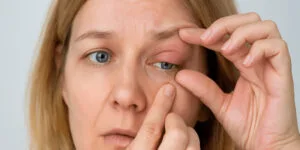 ¿Por qué tengo los párpados hinchados al despertar?