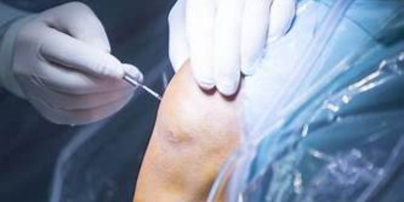 precio operación menisco