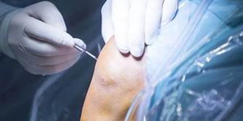 precio operación menisco