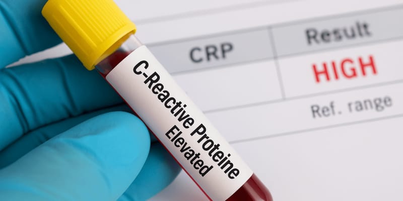 proteína c reactiva