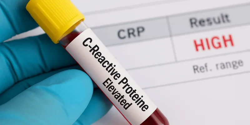 proteína c reactiva