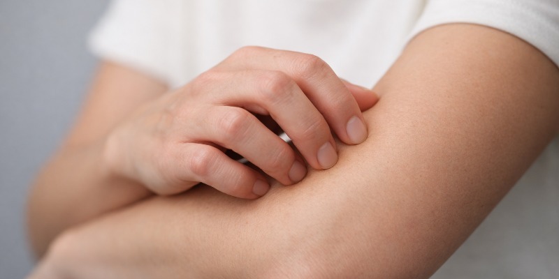 quemazón en la piel