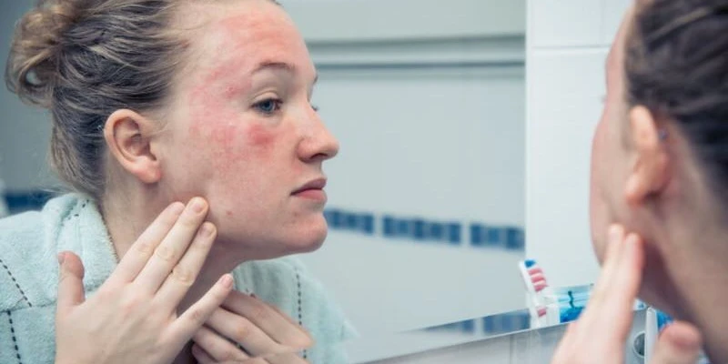 reacción alérgica cremas