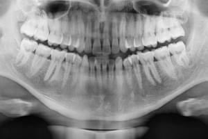 Ortopantomografía Radiodiagnóstico en Écija