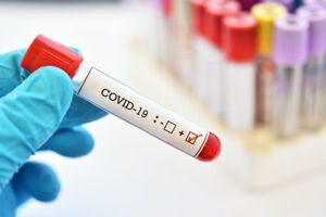 Test de inmunidad coronavirus. Serología IGM, IGG