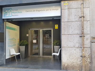 Affidea Grup Manchón Balmes Radiografía. Una proyección de tórax en Barcelona