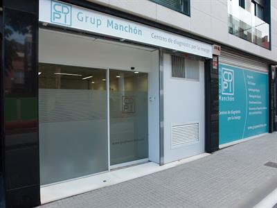 Affidea Grup Manchón Sant Jordi Radiografía. Una proyección de tórax en Barcelona